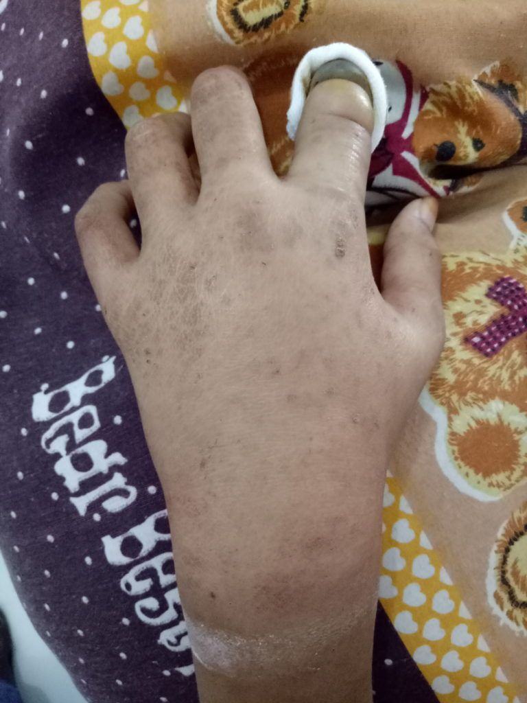 Digigit Tikus