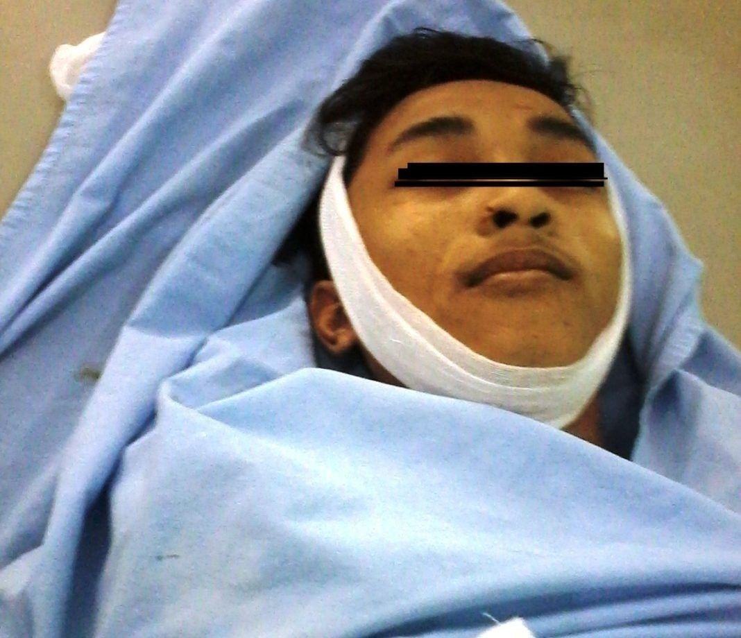 Ayah Angkat Diduga Tikam Anak Tiri