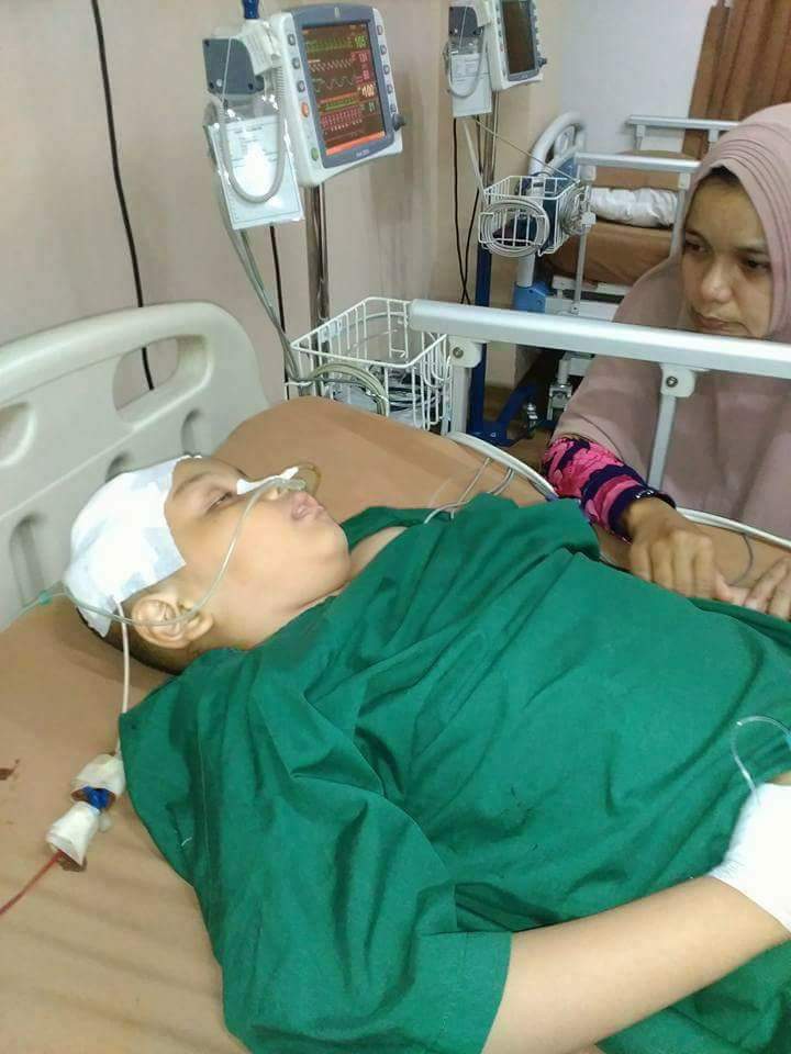 Badila Penderita Virus Otak Medan