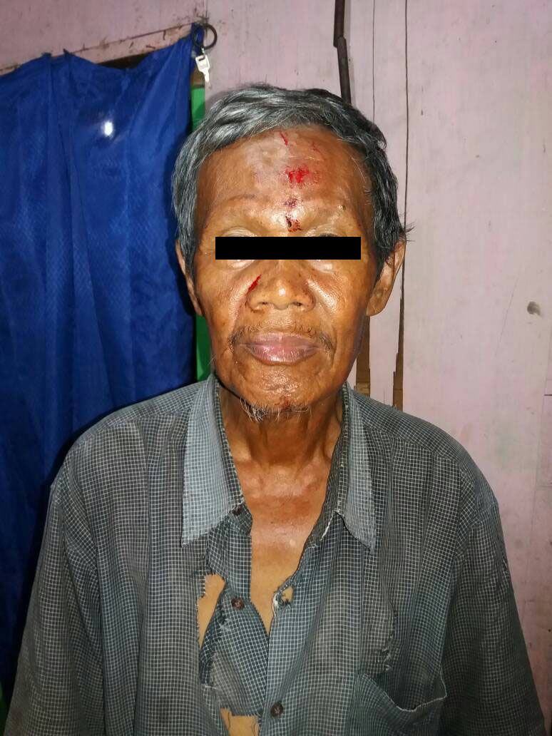 Pencabulan Medan Modal Dua Ribu