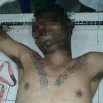 Pelaku Jambret Medan, Satu Tewas dan Satu Kritis Dihajar Massa 10
