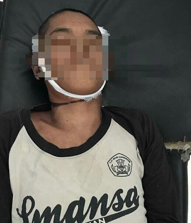 Lapas Anak Medan