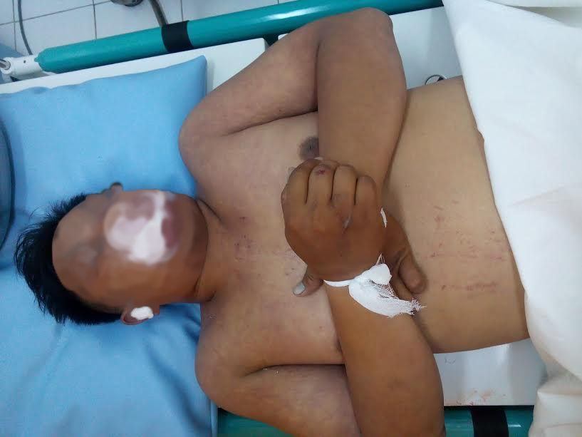 Lakalantas Batubara Tewas