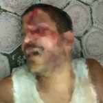 Pelaku Cabul Medan, Nyaris Tewas Dihajar Massa