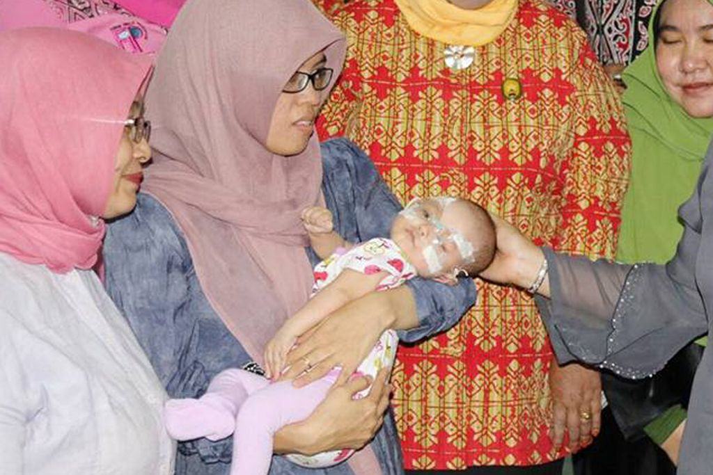 Bayi Penderita Rubella Medan
