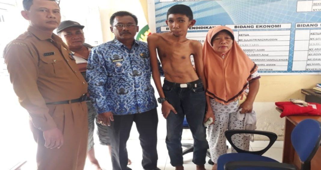 Warga Labuhanbatu Kehilangan Rahang, Butuh Uluran Tangan