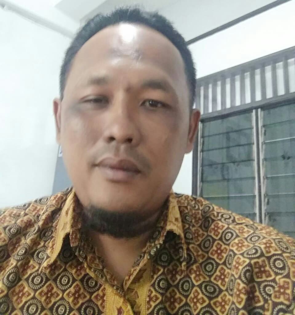 CAS Sumut, Sesalkan Kapoldasu Ogah Minta Maaf soal Pintor Sitorus