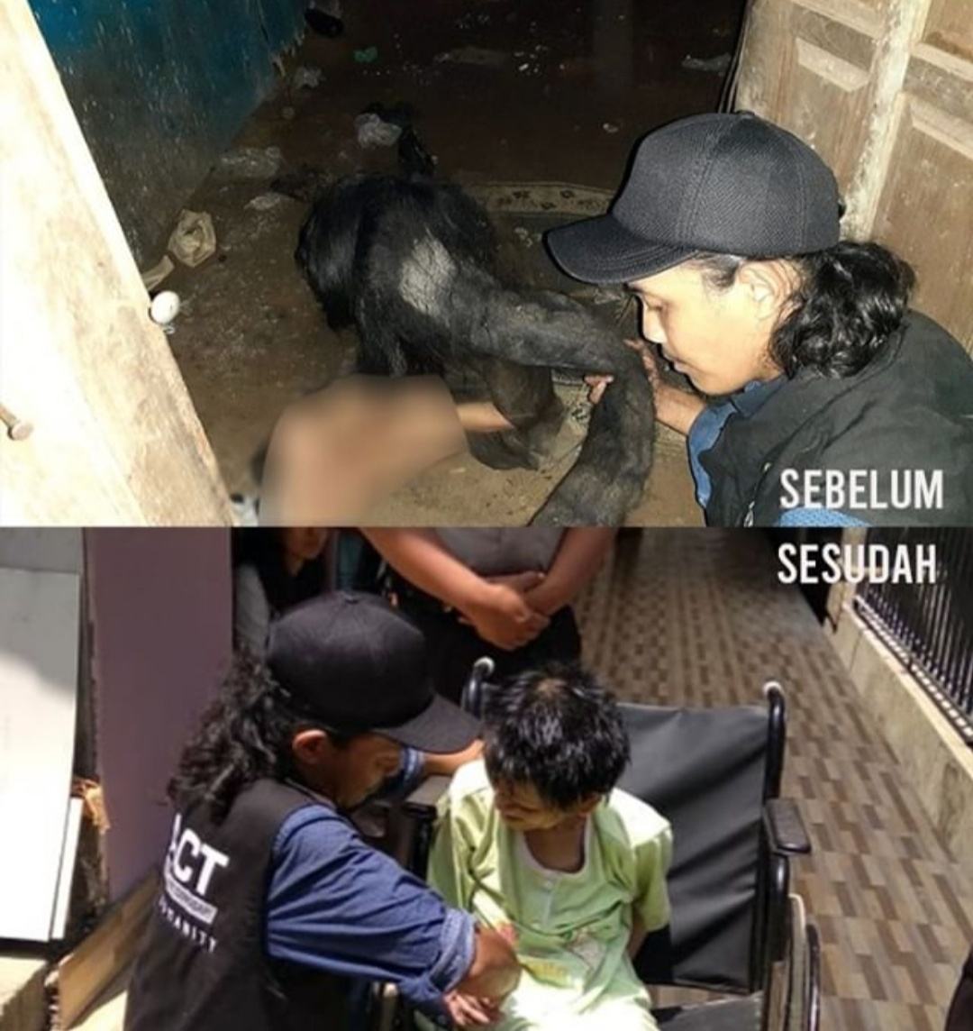 Relawan ACT, Potong Rambut Gimbal 27 Tahun Tidak Dibersihkan
