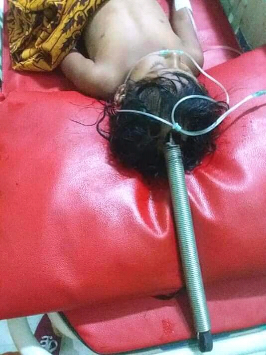 Per Ayunan Menancap di Kepalanya, Nazwa Butuh Kita