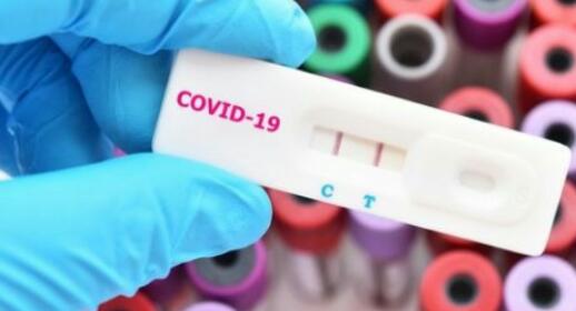 Istri dan Dokter Pribadi Walikota Tanjungpinang Positif Corona