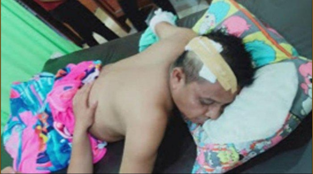 Kepala Desa di Langkat Dikampak, Pelaku Masih Dikejar