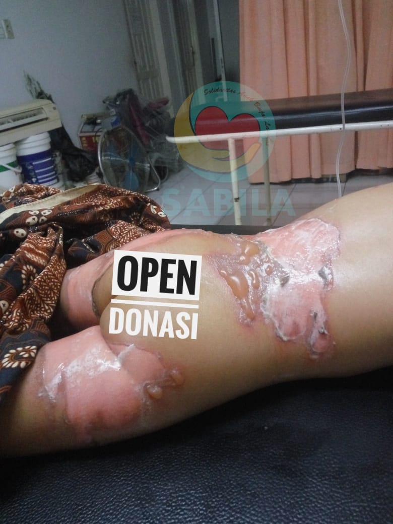 Terjatuh Kedalam Baskom Panas, Ziya Butuh Kita