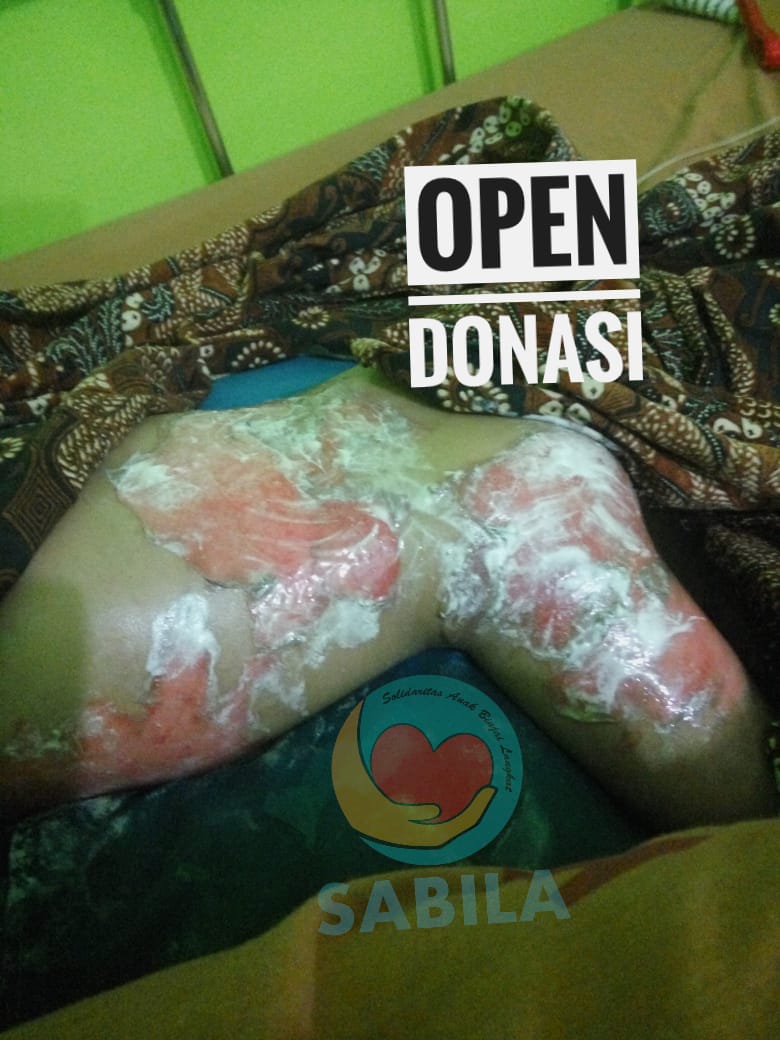 Terjatuh Kedalam Baskom Panas, Ziya Butuh Kita
