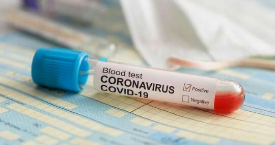 Ahli Biologi Mengklaim Virus Corona Bukan dari Hewan