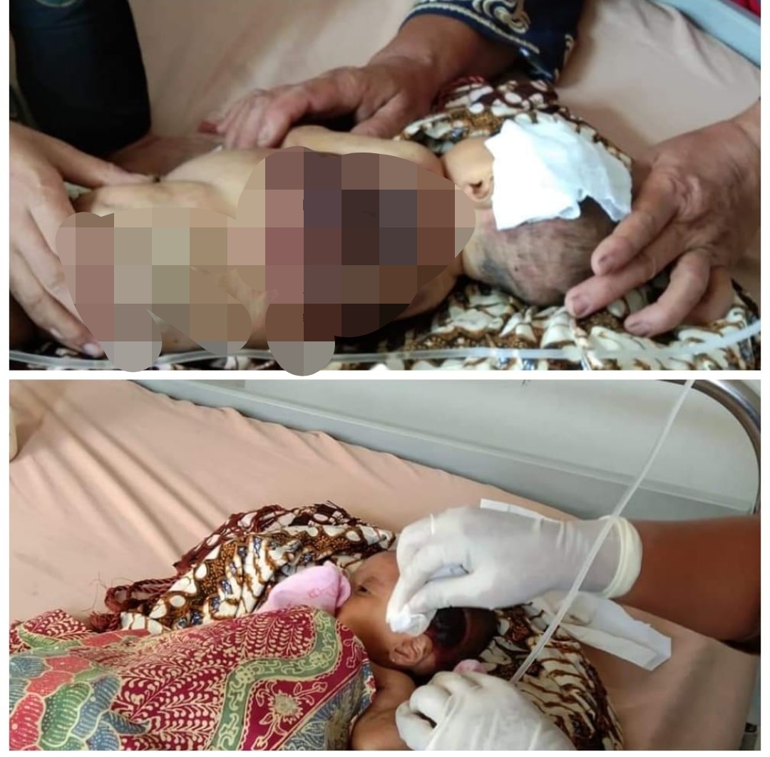 Bayi di Padang Lawas, Butuh Biaya Kita