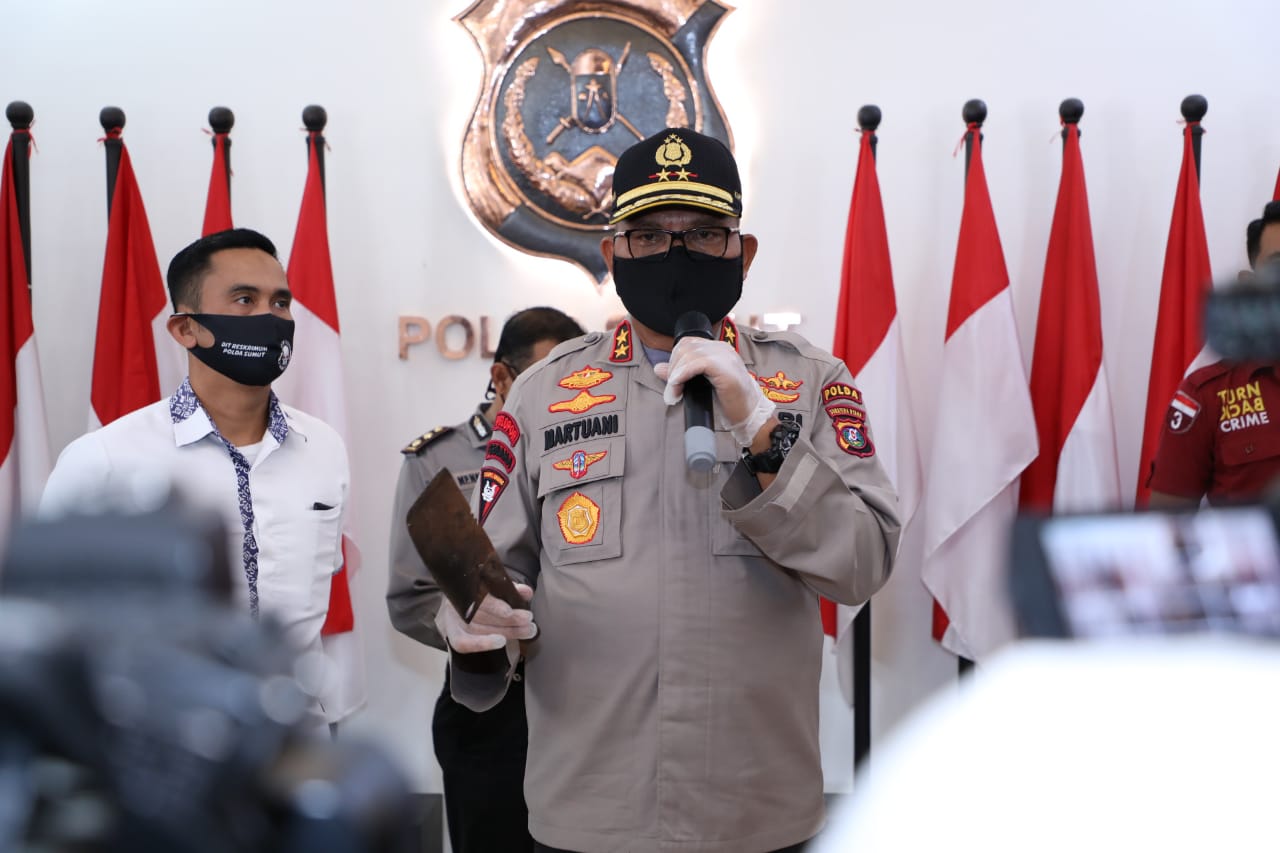 Wanita di Medan, Rela Potong Jari Demi Klaim Asuransi