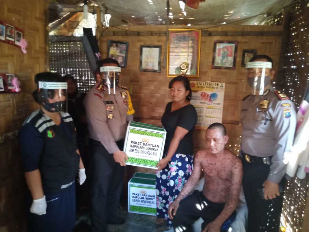 Kapolres Langkat, Jenguk dan Berikan Bantuan kepada Nano