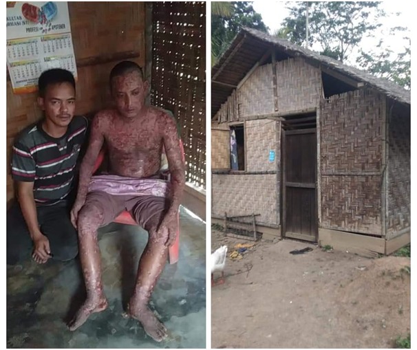 Penjual Kerupuk Keliling di Langkat, Butuh Bantuan untuk Pengobatan