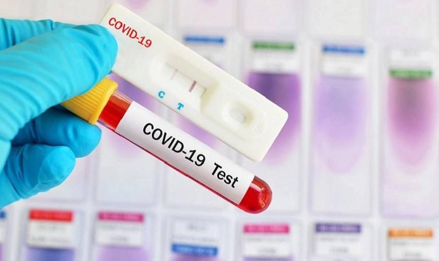 Pemerintah Akan Atur Tarif Tes Swab COVID-19