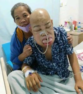 Angakatan Muda Sisingamagaraja, Doakan dan Beri Bantuan Pengidap Kanker Tenggorokan Asal Simalungun