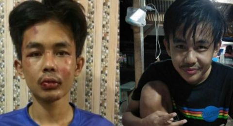 Dokter RSJ Kurungan Nyawa Ikut Periksa Kejiwaan Penusuk Syekh Ali Jaber