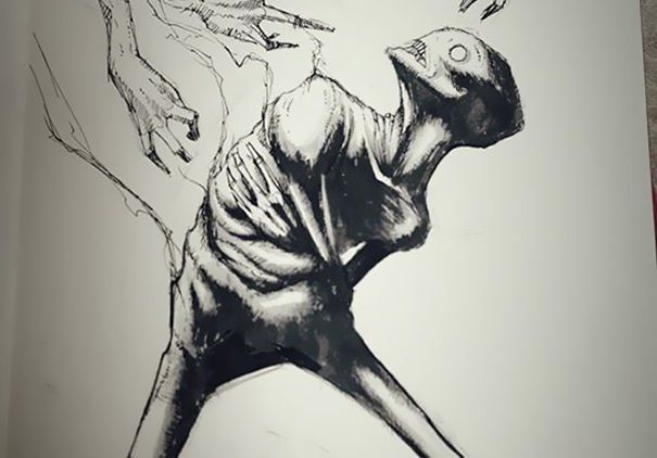 Paranoid Schizofhrenia