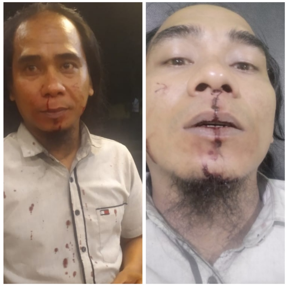 Aktivis Anti Korupsi Sumut