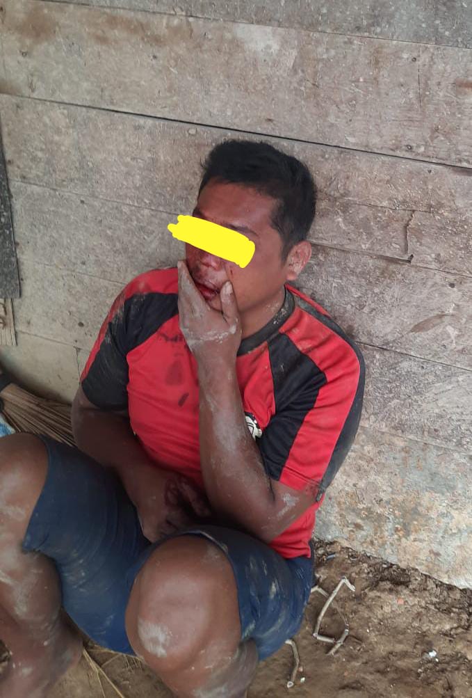 Remas Payudara, Sopir Truck Galian AP3 Di Buluh Telang Babak Belur