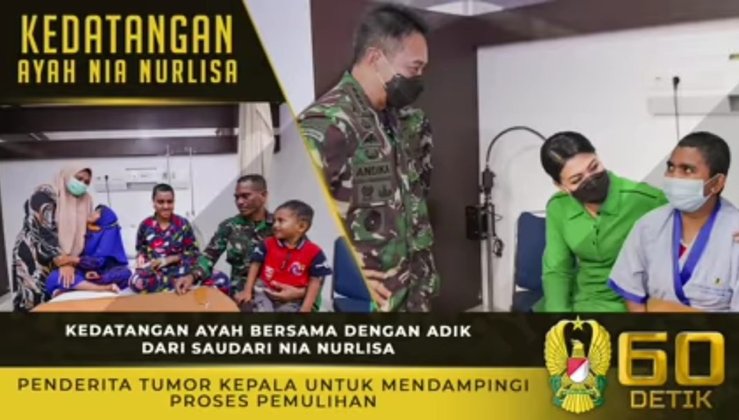 Nia Nurlisa Derita Tumor Kepala, Dapatkan Perawatan Intensif di RSPAD