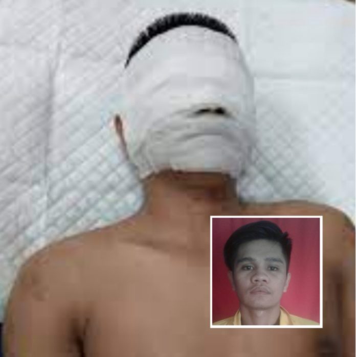 Wartawan di Medan Disiram Air Keras
